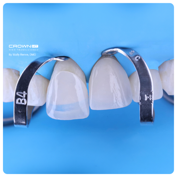 Капсула SprintRay Crown HT