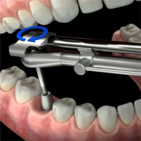 Динамометрический ключ Denflex Torque Wrench Динамометрический ключ Denflex Torque Wrench